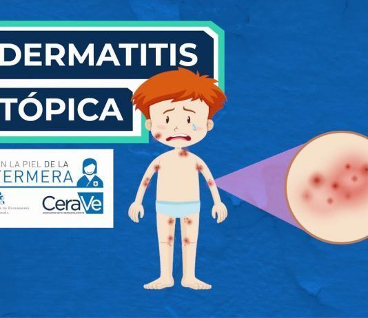 La Organización Colegial da las claves del cuidado de la dermatitis atópica, que afecta a 2 de cada 10 niños y en adultos llega a ser grave