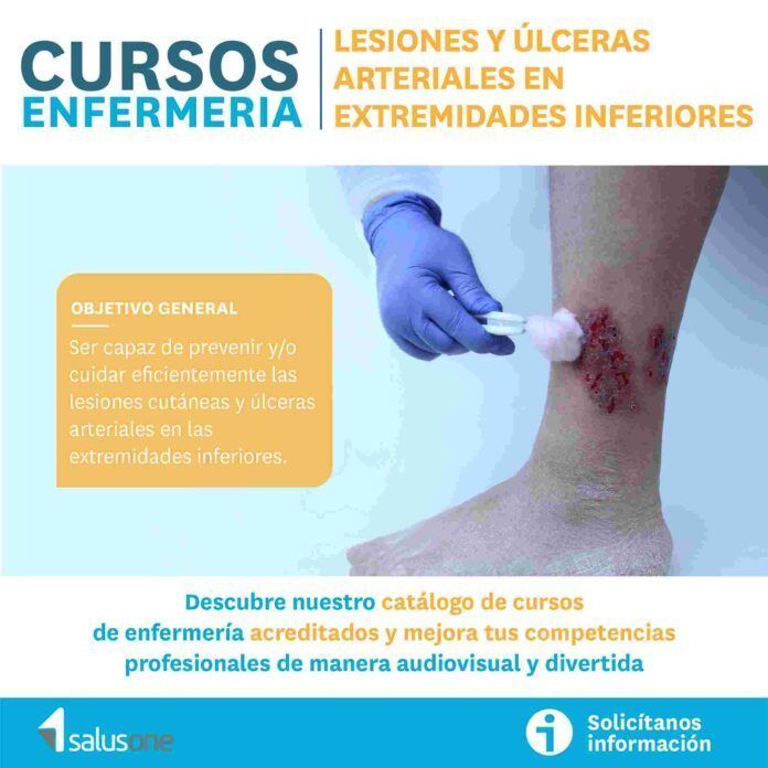 “Lesiones y úlceras arteriales en extremidades inferiores”, el nuevo curso CFC que te ofrece el Colegio