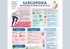 Nuevo prescribe del Colegio: “Alimentación en pacientes con Sarcopenia”