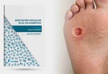 Nuevo ebook descargable: “Afectación vascular en el pie diabético”