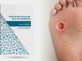 Nuevo ebook descargable: “Afectación vascular en el pie diabético”